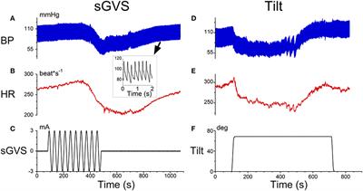 Predicting Vasovagal Responses: A Model-Based and Machine Learning Approach